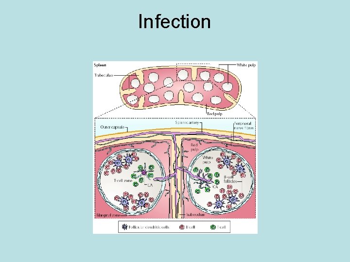 Infection 