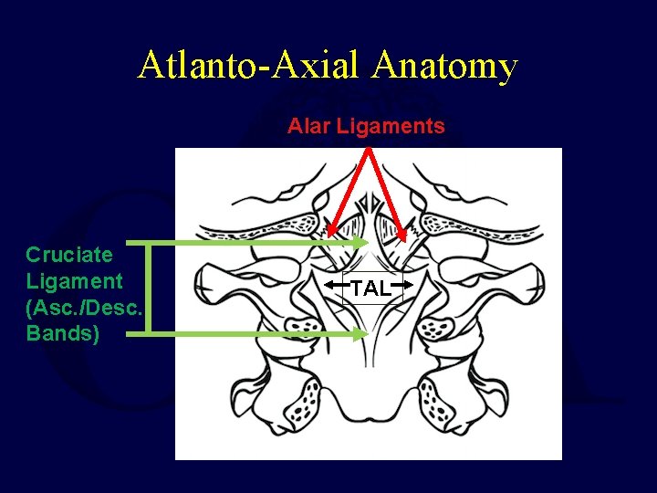 Atlanto-Axial Anatomy Alar Ligaments Cruciate Ligament (Asc. /Desc. Bands) TAL 