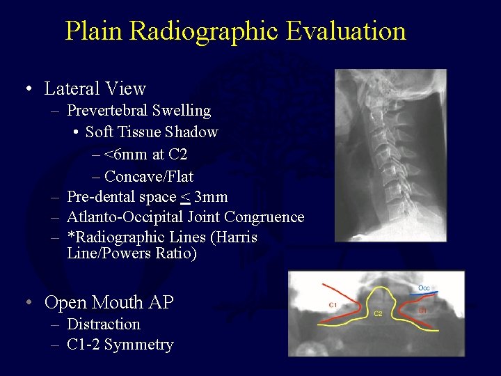 Plain Radiographic Evaluation • Lateral View – Prevertebral Swelling • Soft Tissue Shadow –
