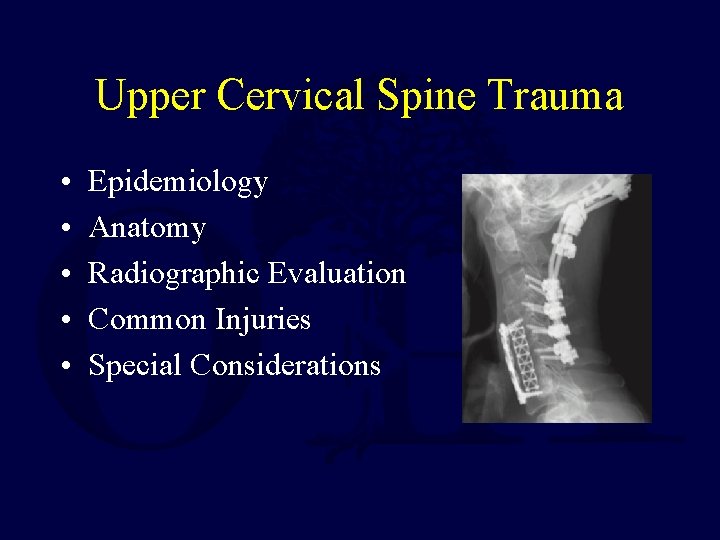 Upper Cervical Spine Trauma • • • Epidemiology Anatomy Radiographic Evaluation Common Injuries Special