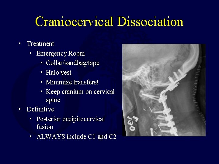 Craniocervical Dissociation • Treatment • Emergency Room • Collar/sandbag/tape • Halo vest • Minimize