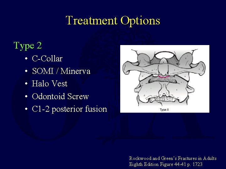 Treatment Options Type 2 • • • C-Collar SOMI / Minerva Halo Vest Odontoid