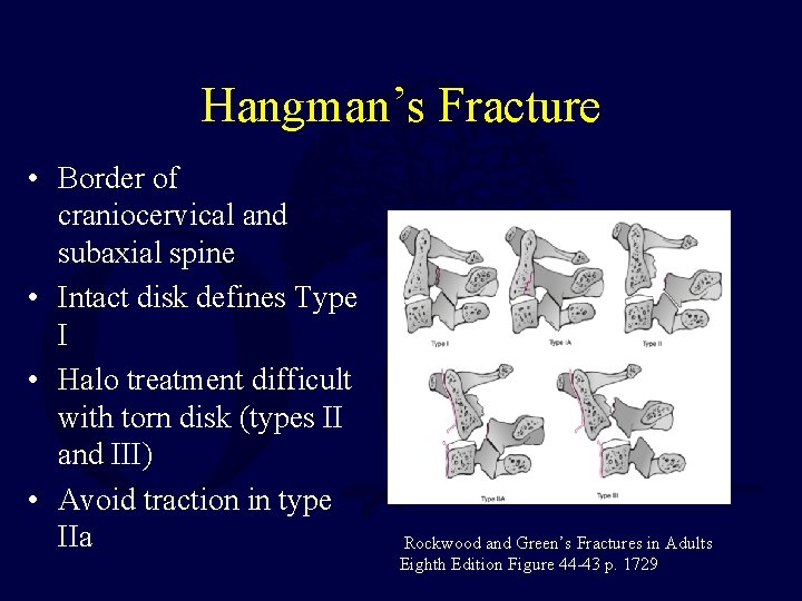Hangman’s Fracture • Border of craniocervical and subaxial spine • Intact disk defines Type