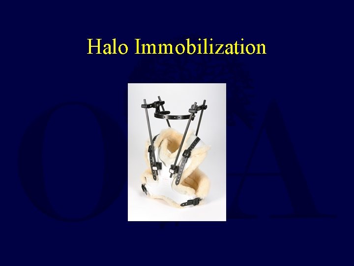 Halo Immobilization 