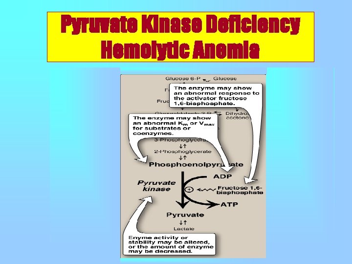 Pyruvate Kinase Deficiency Hemolytic Anemia 