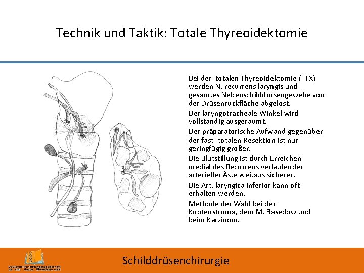 Technik und Taktik: Totale Thyreoidektomie Bei der totalen Thyreoidektomie (TTX) werden N. recurrens laryngis