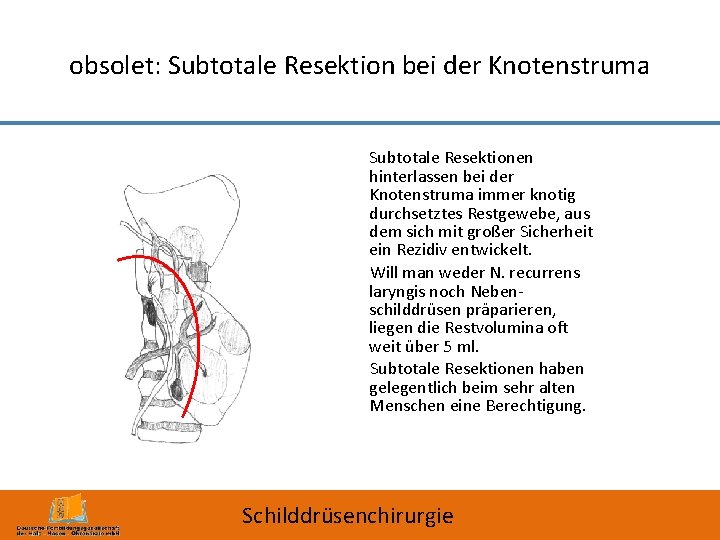 obsolet: Subtotale Resektion bei der Knotenstruma Subtotale Resektionen hinterlassen bei der Knotenstruma immer knotig