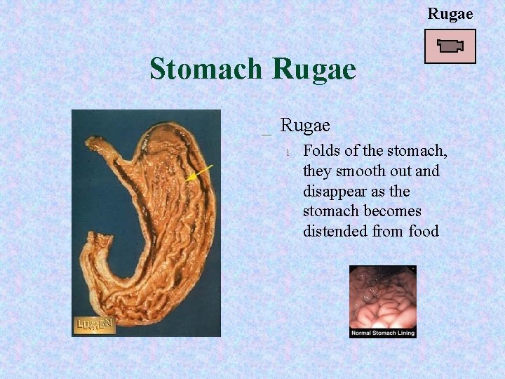 Rugae Stomach Rugae _ Rugae l Folds of the stomach, they smooth out and