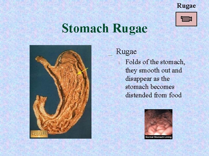 Rugae Stomach Rugae _ Rugae l Folds of the stomach, they smooth out and Rugae Stomach Rugae _ Rugae l Folds of the stomach, they smooth out and