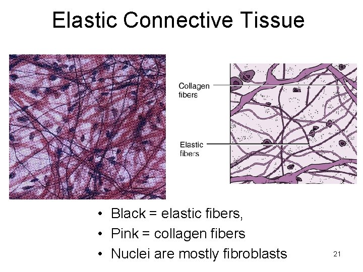 Elastic Connective Tissue • Black = elastic fibers, • Pink = collagen fibers •