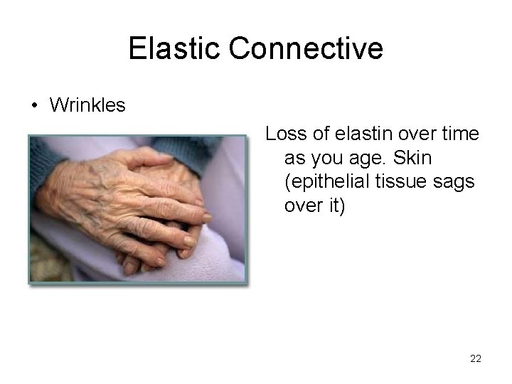 Elastic Connective • Wrinkles Loss of elastin over time as you age. Skin (epithelial