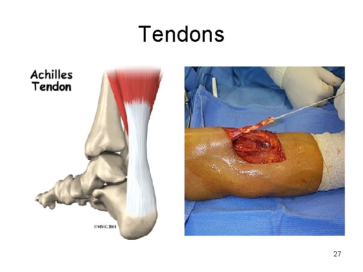 Tendons 27 