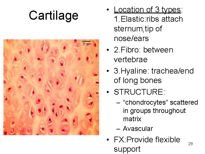 Cartilage • Location of 3 types: 1. Elastic: ribs attach sternum, tip of nose/ears