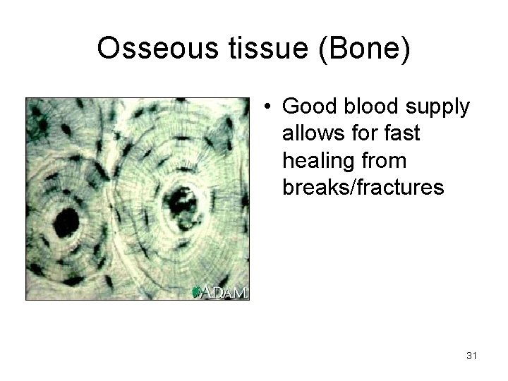 Osseous tissue (Bone) • Good blood supply allows for fast healing from breaks/fractures 31