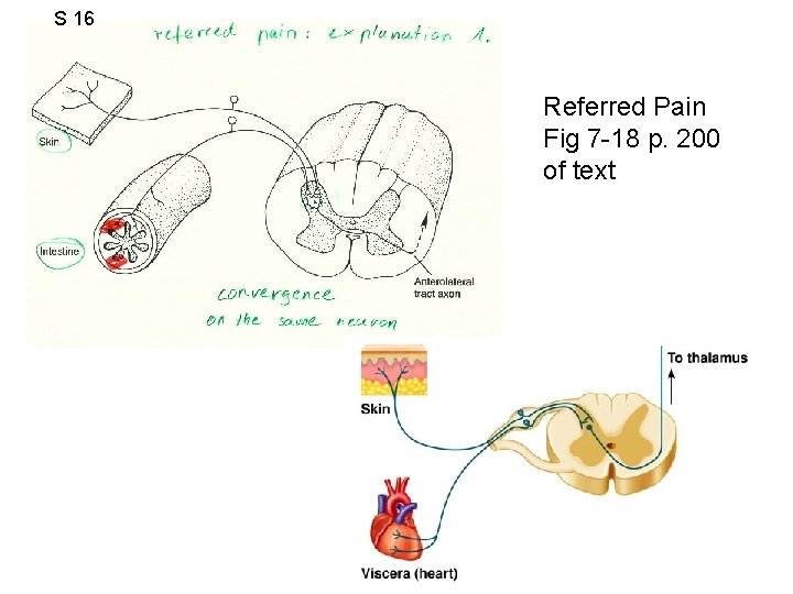 S 16 Referred Pain Fig 7 -18 p. 200 of text 
