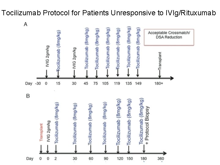 Tocilizumab Protocol for Patients Unresponsive to IVIg/Rituxumab 