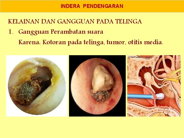 INDERA PENDENGARAN KELAINAN DAN GANGGUAN PADA TELINGA 1. Gangguan Perambatan suara Karena: Kotoran pada