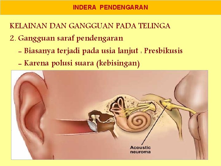 INDERA PENDENGARAN KELAINAN DAN GANGGUAN PADA TELINGA 2. Gangguan saraf pendengaran - Biasanya terjadi