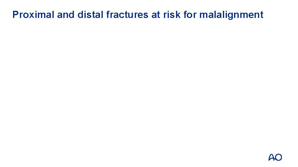 Proximal and distal fractures at risk for malalignment 