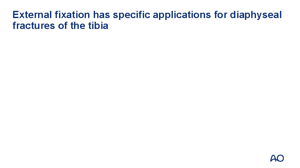 External fixation has specific applications for diaphyseal fractures of the tibia 