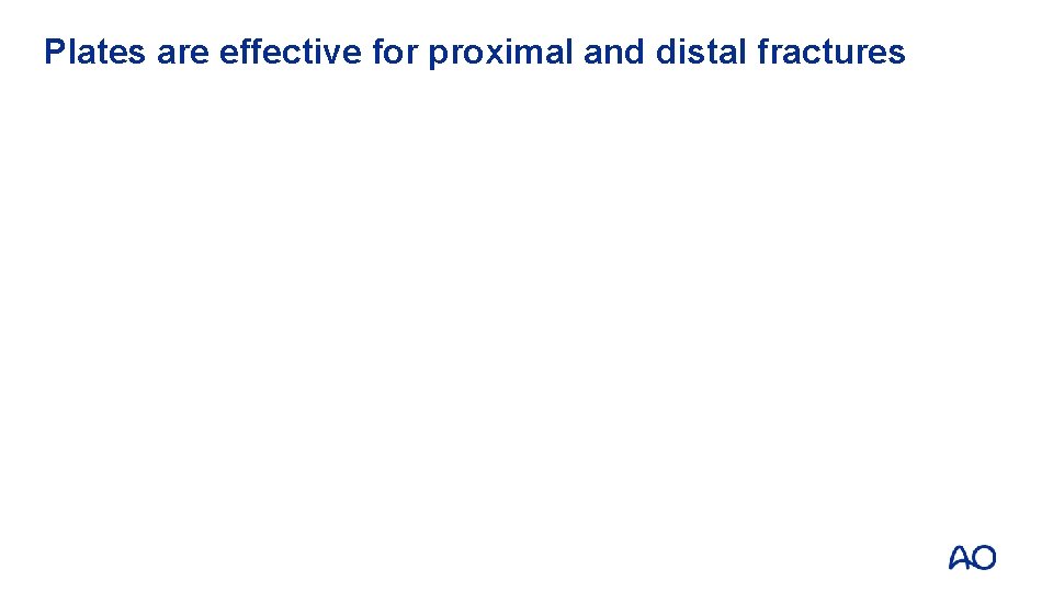 Plates are effective for proximal and distal fractures 