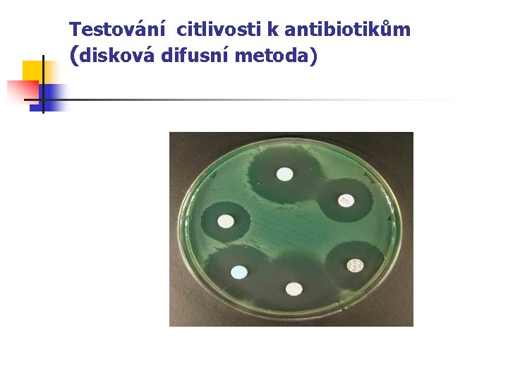 Testování citlivosti k antibiotikům (disková difusní metoda) 