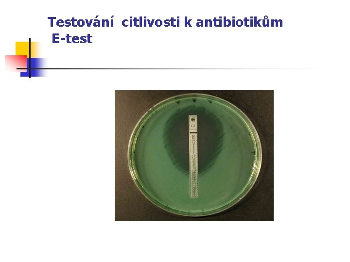 Testování citlivosti k antibiotikům E-test 