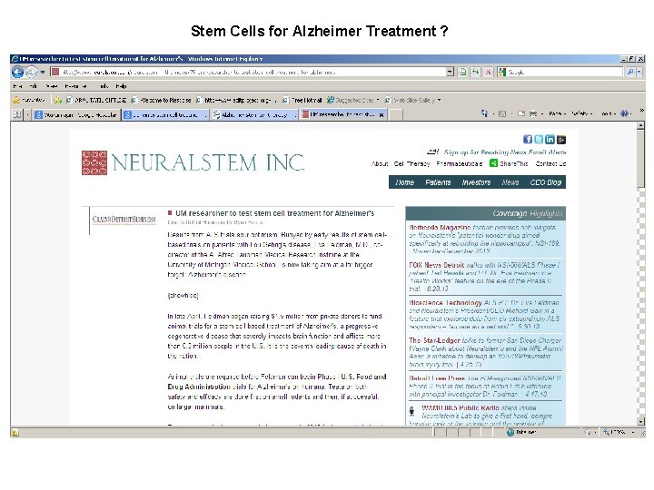 Stem Cells for Alzheimer Treatment ? 