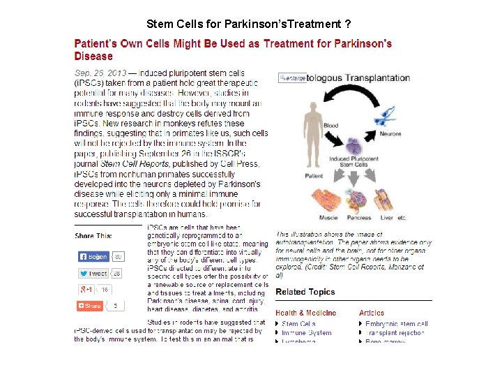 Stem Cells for Parkinson’s. Treatment ? 