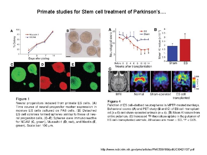 Primate studies for Stem cell treatment of Parkinson’s. . http: //www. ncbi. nlm. nih.