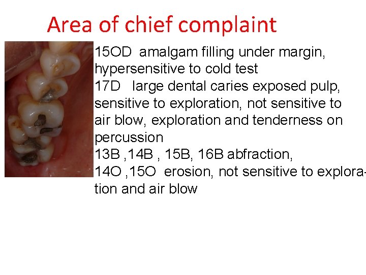 Area of chief complaint 15 OD amalgam filling under margin, hypersensitive to cold test