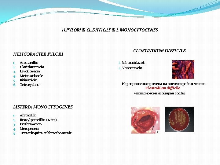 H. PYLORI & CL. DIFFICILE & L. MONOCYTOGENES HELICOBACTER PYLORI 1. 2. 3. 4.