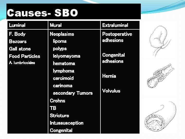 Causes- SBO Luminal Mural Extraluminal F. Body Bezoars Gall stone Food Particles Neoplasims lipoma