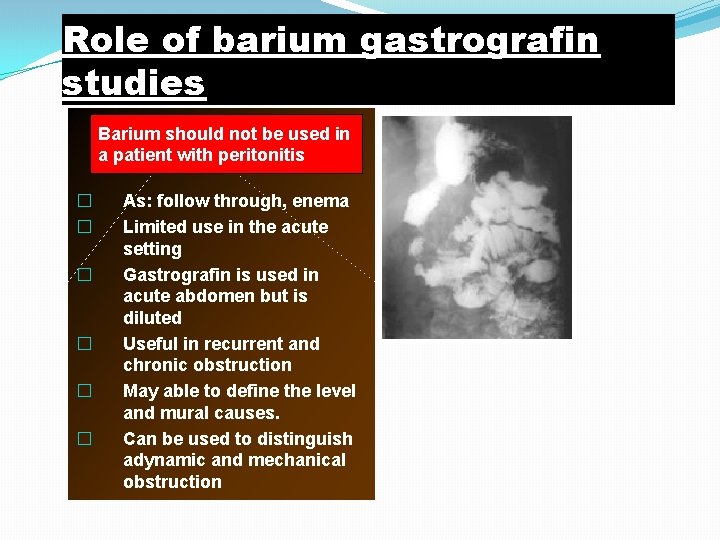 Role of barium gastrografin studies Barium should not be used in a patient with