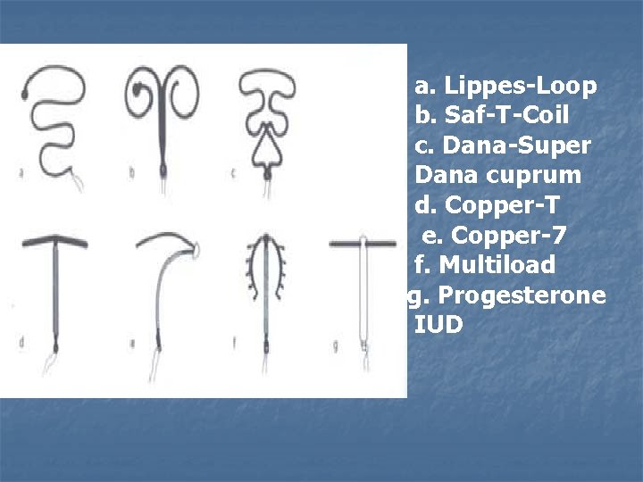 a. Lippes-Loop b. Saf-T-Coil c. Dana-Super Dana cuprum d. Copper-T e. Copper-7 f. Multiload