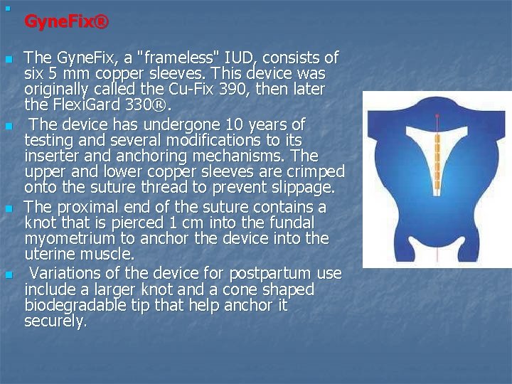 n n n Gyne. Fix® The Gyne. Fix, a "frameless" IUD, consists of six