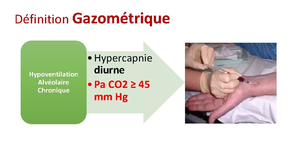 Définition Gazométrique Hypoventilation Alvéolaire Chronique • Hypercapnie diurne • Pa CO 2 ≥ 45