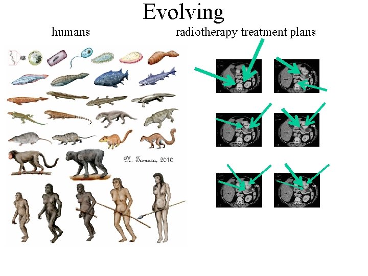 Evolving humans radiotherapy treatment plans 