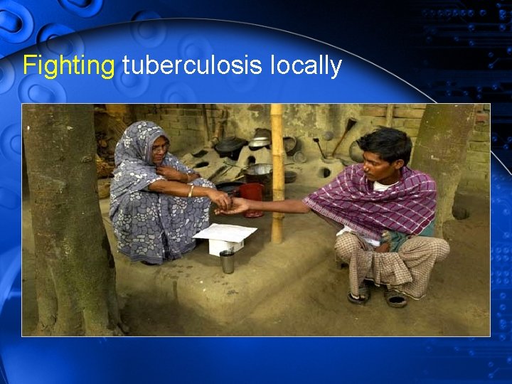 Fighting tuberculosis locally 