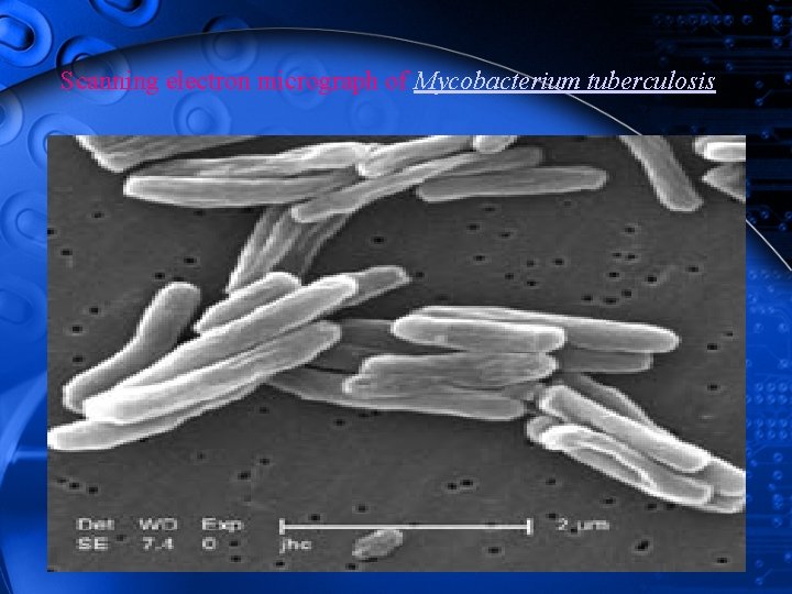 Scanning electron micrograph of Mycobacterium tuberculosis 