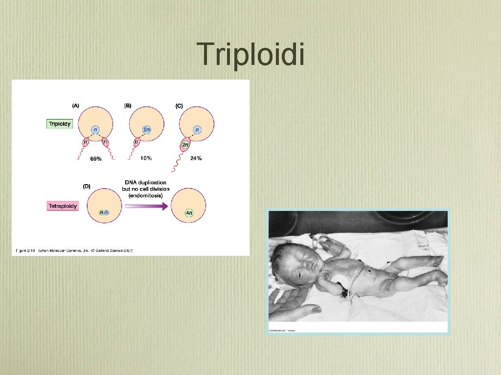 Triploidi 