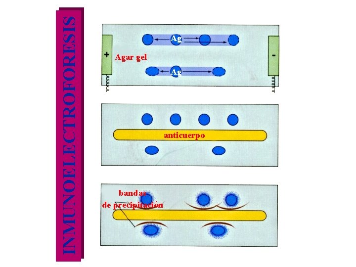 INMUNOELECTROFORESIS Ag Agar gel Ag anticuerpo bandas de precipitación 