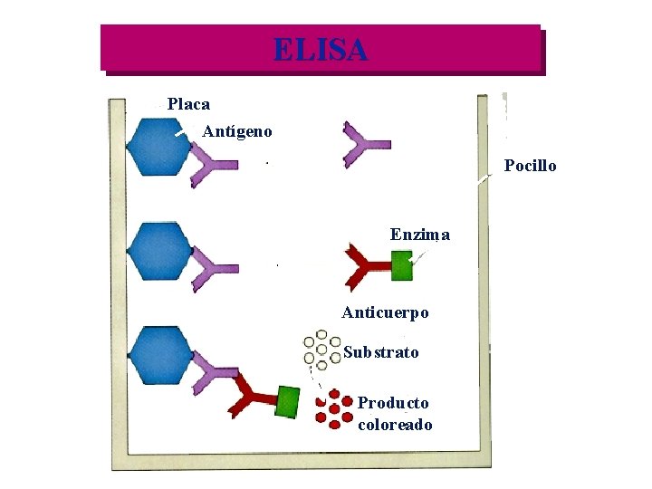 ELISA Placa Antígeno Pocillo Enzima Anticuerpo Substrato Producto coloreado 
