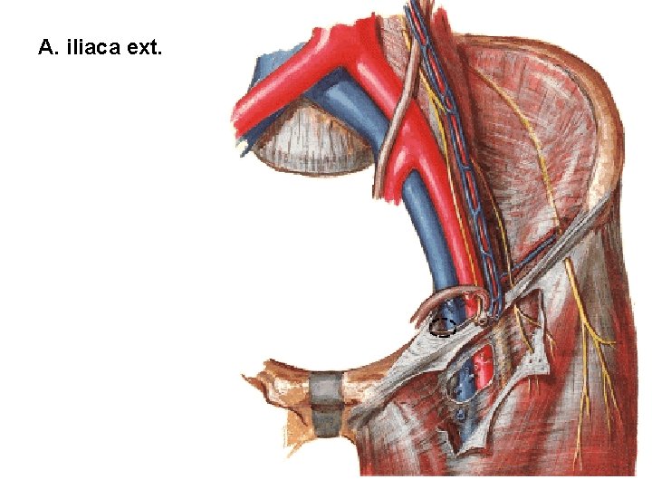 A. iliaca ext. 