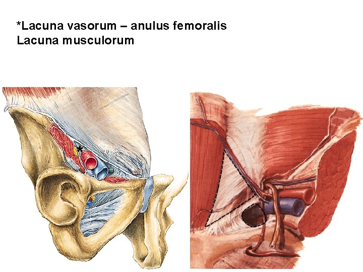 *Lacuna vasorum – anulus femoralis Lacuna musculorum * 