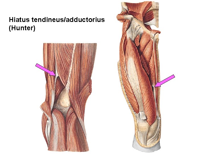 Hiatus tendineus/adductorius (Hunter) 