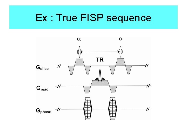 Ex : True FISP sequence 