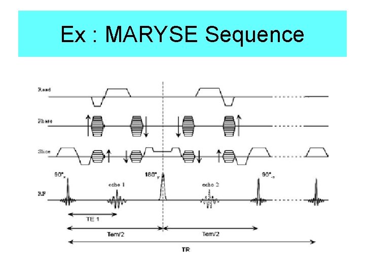 Ex : MARYSE Sequence 