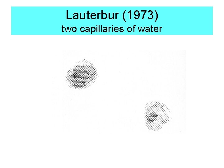 Lauterbur (1973) two capillaries of water 