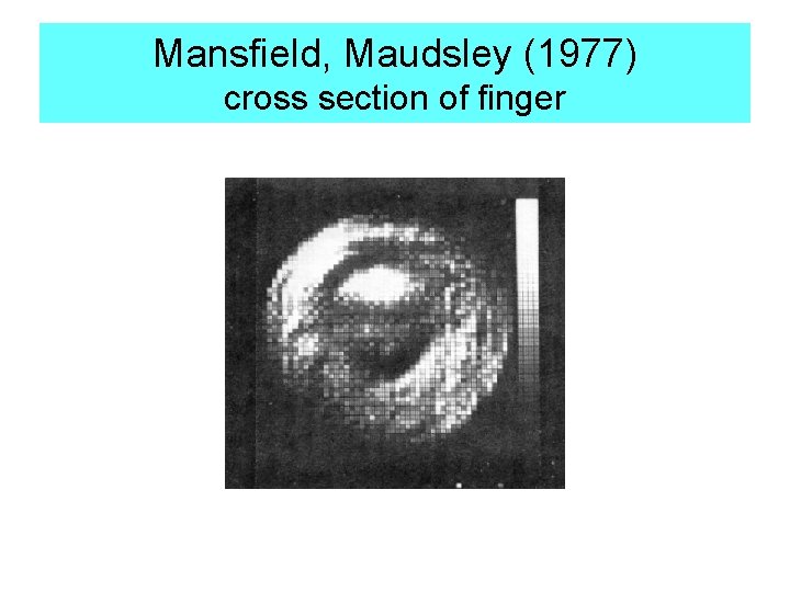 Mansfield, Maudsley (1977) cross section of finger 